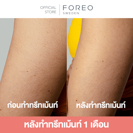 เครื่องกำจัดขน IPL FOREO PEACH 2 Mint_6